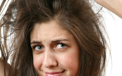 Am I going bald??